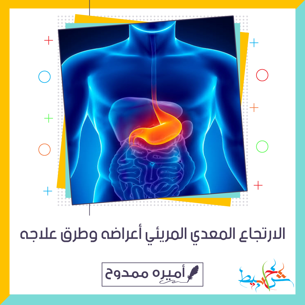 الارتجاع المعدي المريئي | أعراضه وطرق علاجه